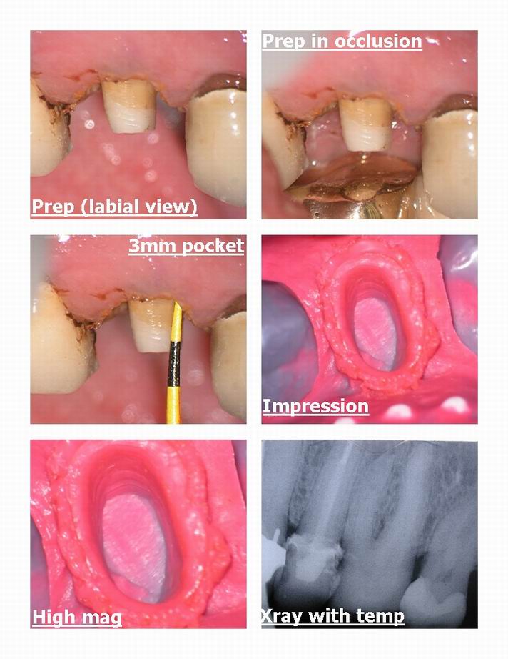 DM osseous pg 4.jpg